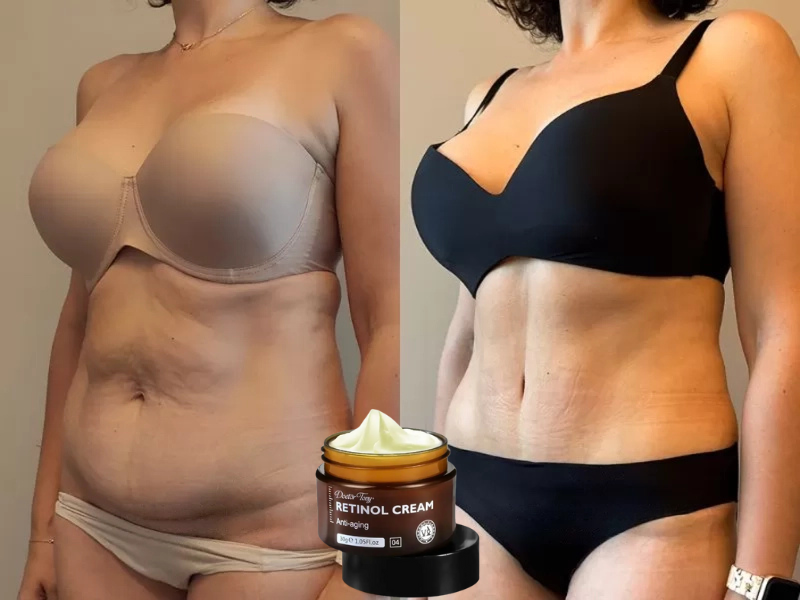 Cremă Rejuvenantă și Anti-Îmbătrânire – PLĂTEȘTI LA LIVRARE
