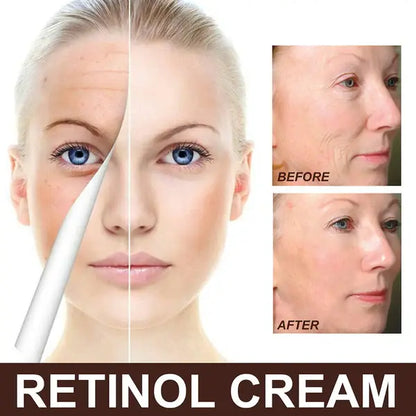 Cremă Rejuvenantă și Anti-Îmbătrânire – PLĂTEȘTI LA LIVRARE